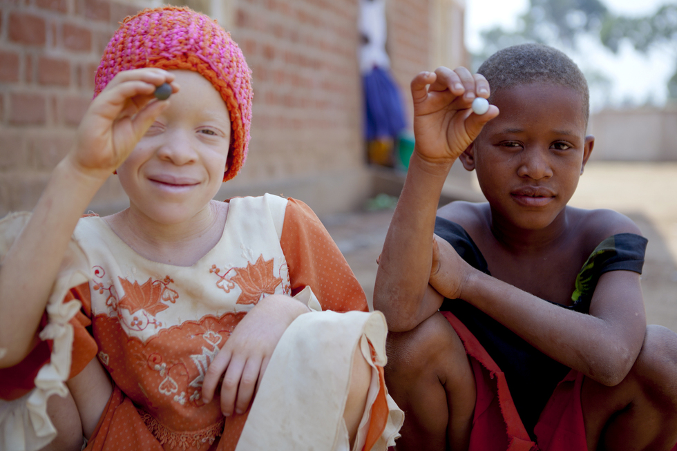 La maldición de las albinas (y los albinos) Blog Mujeres EL PAÍS