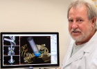 Un modelo virtual permite predecir el efecto de la radioterapia