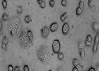 Descubiertos biomarcadores de la enfermedad de Chagas