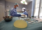 La CE no ve más riesgo en los implantes PIP que en otros