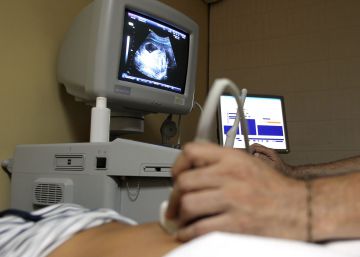 Los tribunales rechazan que los médicos tengan un ?derecho absoluto? a objetar del aborto