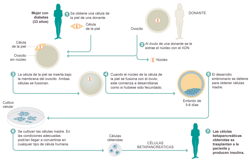 Clonación terapéutica para diabetes Actualidad EL PAÍS