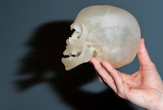 Un Rostro Nuevo Para Violet Gracias A Una Impresora 3d Ciencia