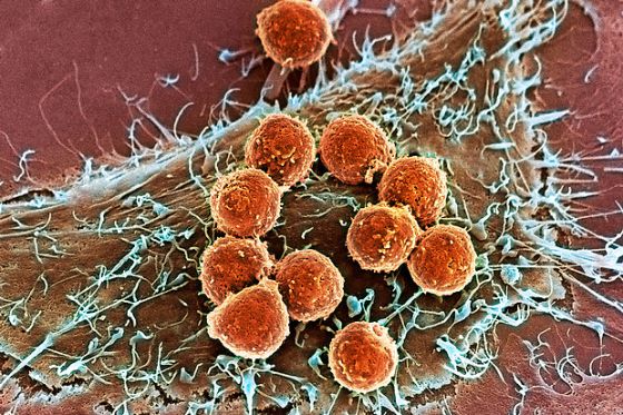 Resultado de imagen de celulas contra el cancer