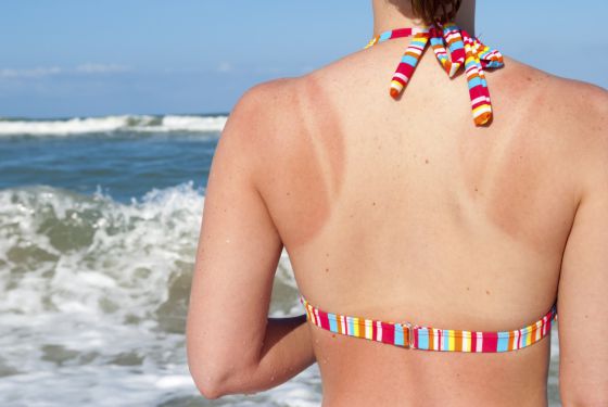 Cuanto dura el bronceado de rayos uva
