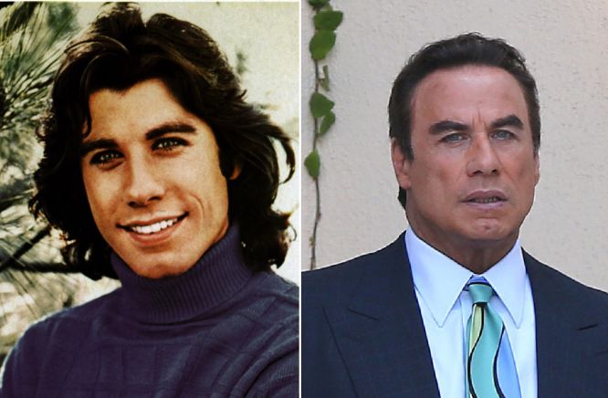 John Travolta se ha estirado tanto la piel que las redes sociales no han tardo mucho en apodarlo como: el hombre de cera. Su rostro se ha quedado casi sin facciones y su sonrisa es casi nula, pues tiene muy tensos los músculos faciales.
