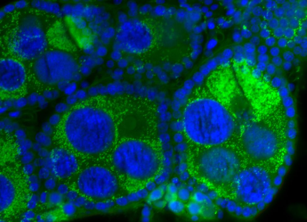 La guerra de la ciencia contra el mosquito del zika | Ciencia | EL PAÍS