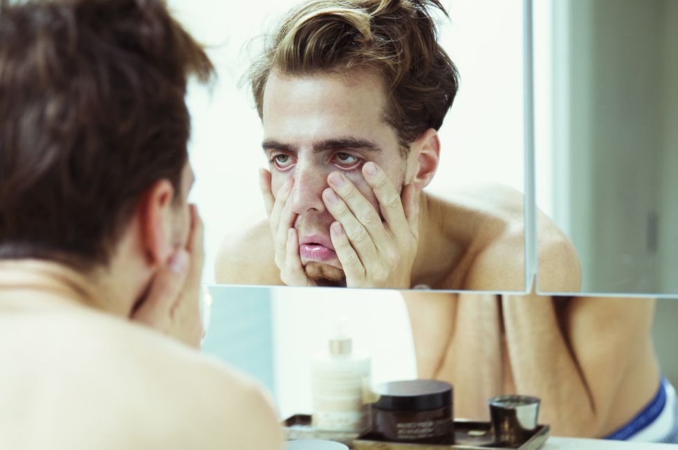 Ayuda a las ojeras vitamina qué