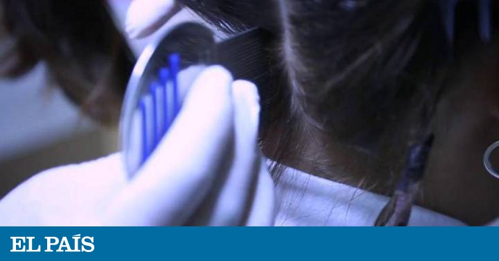 Cómo deshacerse del video de piojos