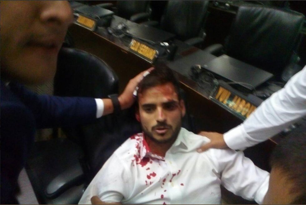 El diputado Armando Armas, herido durante los disturbios.