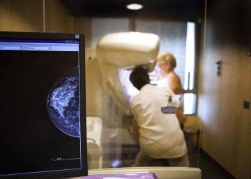 Las limitaciones de las mamografías