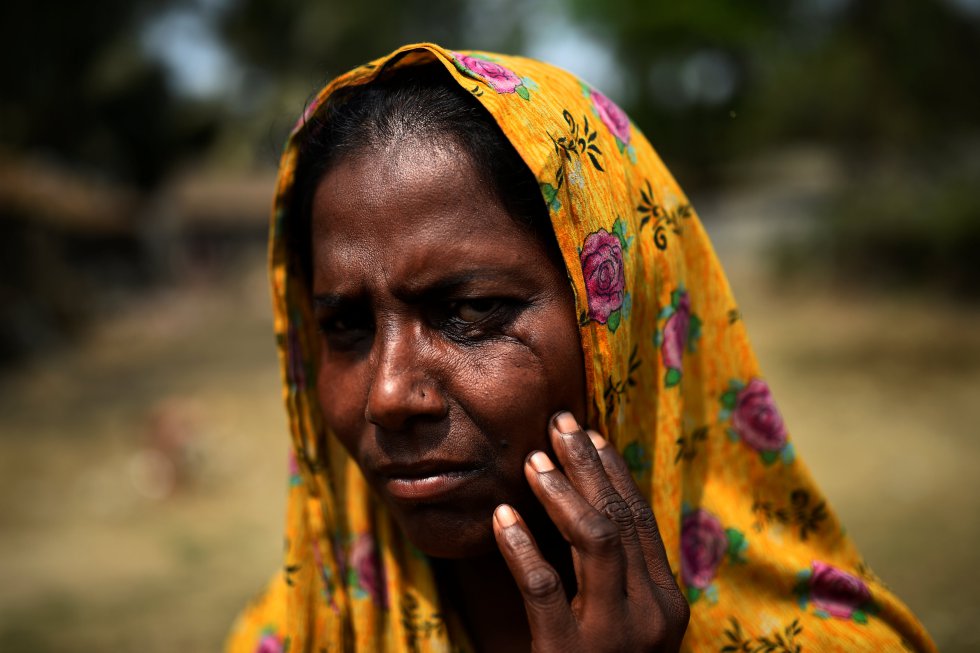 Hasina Begum, refugiada rohingya de 30 años, "me hirieron con una espada en la cara, después perdí la consciencia algunos de mis vecinos me llevaron a un barco para cruzar la frontera con Bangladés", así terminó en un campo de refugiados, "es una vida mejor, puedo trabajar secando pescado y gano dinero".