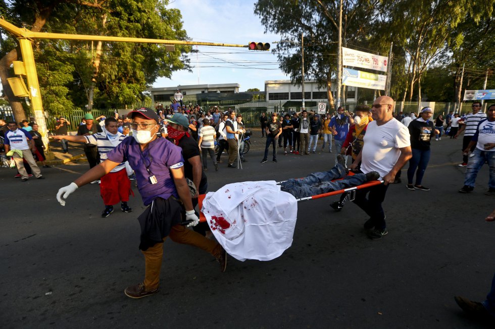 Paramédicos trasladan a un manifestante que fue abatido de un tiro en la cabeza durante los disturbios por las protestas contra el presidente Daniel Ortega en Managua (Nicaragua), el 30 de mayo de 2018.