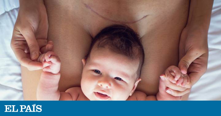 Dolor de cabeza y sensación de frío después de una cesárea Dolor de cabeza y sensación de frío después de una cesárea