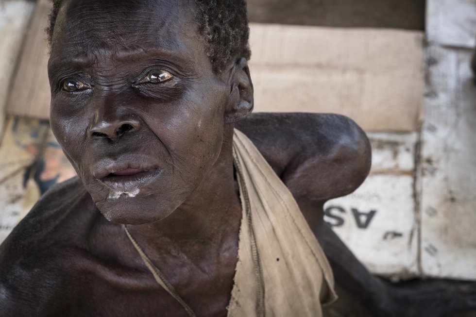 Como tantos sudaneses del sur, esta anciana sufre de inaniciÃ³n. Desde la crisis de 2013, los dos bandos rivales mantienen un enfrentamiento que ha costado al paÃ­s una guerra civil, combates, enfermedades y hambre.