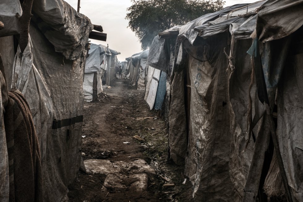 El campo de protecciÃ³n de civiles, en el que las tiendas se adosan unas a otras sin ninguna intimidad, es un paraÃ­so para las epidemias. A lo largo de los Ãºltimos aÃ±os, sus instalaciones, que forman uno de los mayores campamentos para desplazados internos y refugiados de SudÃ¡n del Sur bajo la protecciÃ³n de UNMISS, han acogido a alrededor de 115.000 personas en tiendas provisionales. Tras los enfrentamientos en la zona y hasta finales de 2013 llegaron sobre todo miembros de la tribu nuer en busca de refugio. Sucesivamente, su poblaciÃ³n fue aumentando.