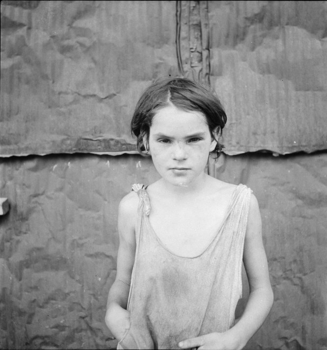 CrianÃ§a ferida, Shacktown, Elm Grove, Oklahoma, 1936
