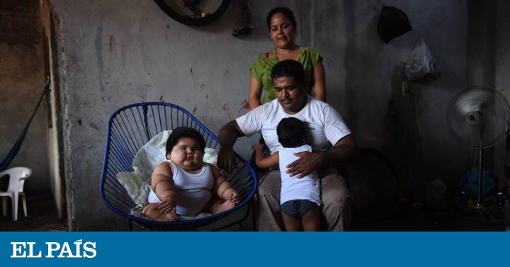 Enfermedades provocadas por el sobrepeso