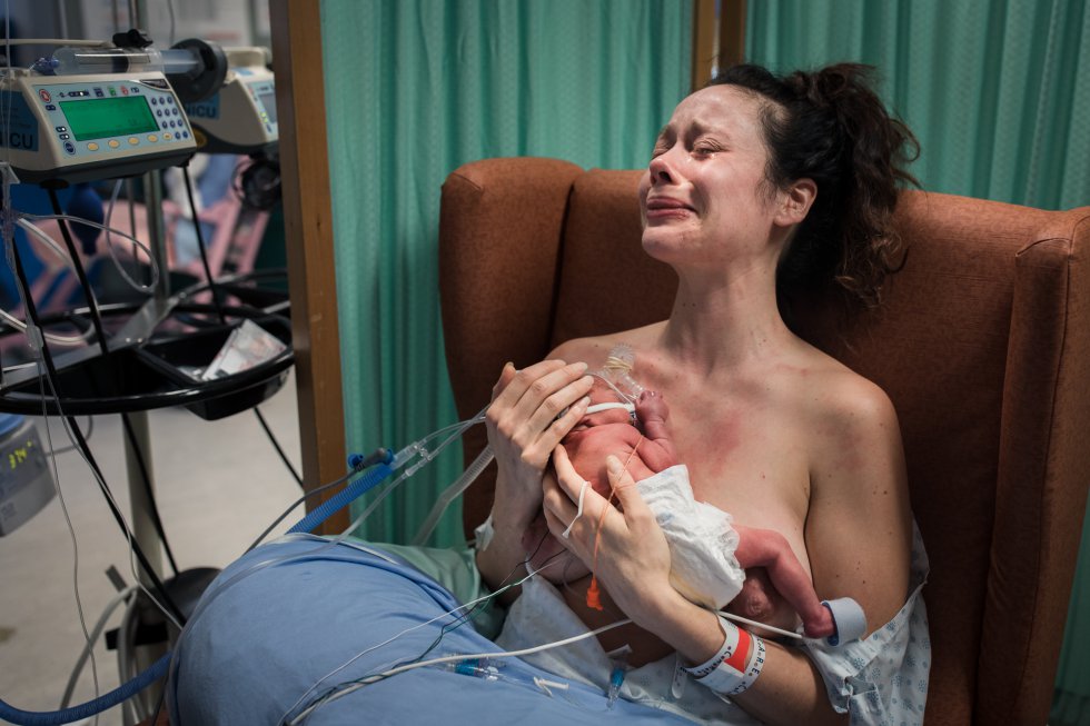 Fotos: As melhores fotos de parto e pós-parto de 2018