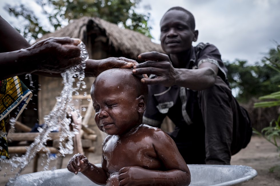 Pierre Nakifi tiene tres aÃ±os y medio y vive en el pueblo de Bamba, a las afueras de Bangui, en la RepÃºblica Centroafricana. Es huÃ©rfano de madre y en su breve vida ya ha estado dos veces cerca de morir debido a la malnutriciÃ³n. El pasado verano, empezÃ³ a perder peso y a rechazar la comida. Su padre, por miedo a no poder pagar un tratamiento en el centro de salud, recurriÃ³ a la medicina tradicional, pero la diarrea del niÃ±o seguÃ­a sin remitir. Pierre llegÃ³ a pesar nueve kilos y su padre, asustado, le llevÃ³ al hospital pediÃ¡trico de la capital. Tras recibir cuidado mÃ©dico, consiguiÃ³ ganar peso.