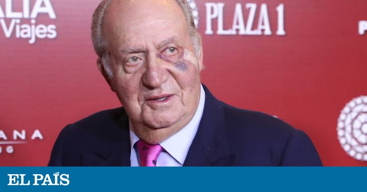 gente con los ojos morados