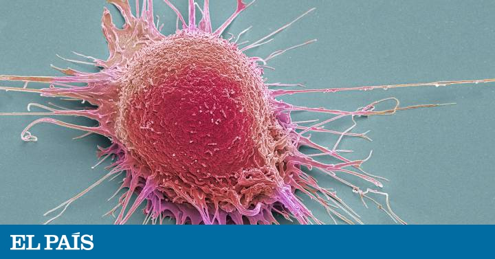 Síntomas y curas del cáncer de próstata 2020