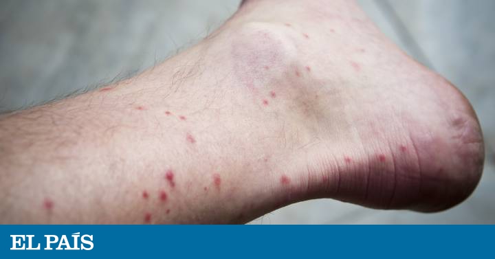 ¿Por qué los mosquitos se ceban con nuestros tobillos?