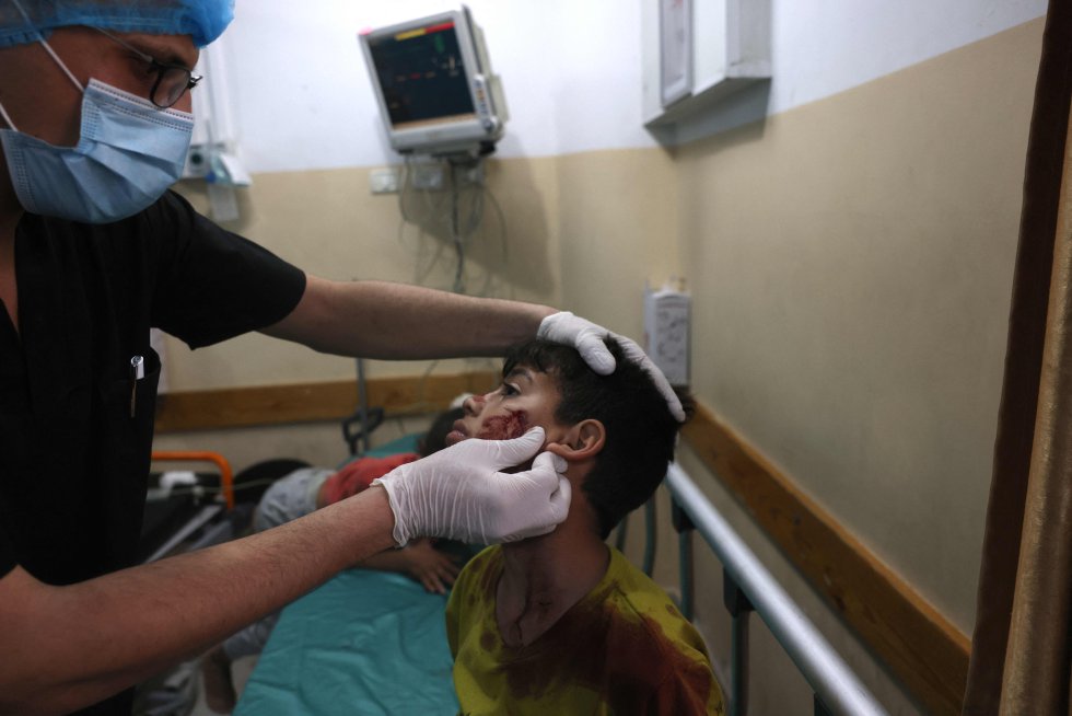 Un niño recibe atención sanitaria tras el bombardeo de Israel, este lunes en un hospital de la zona norte de la franja de Gaza.