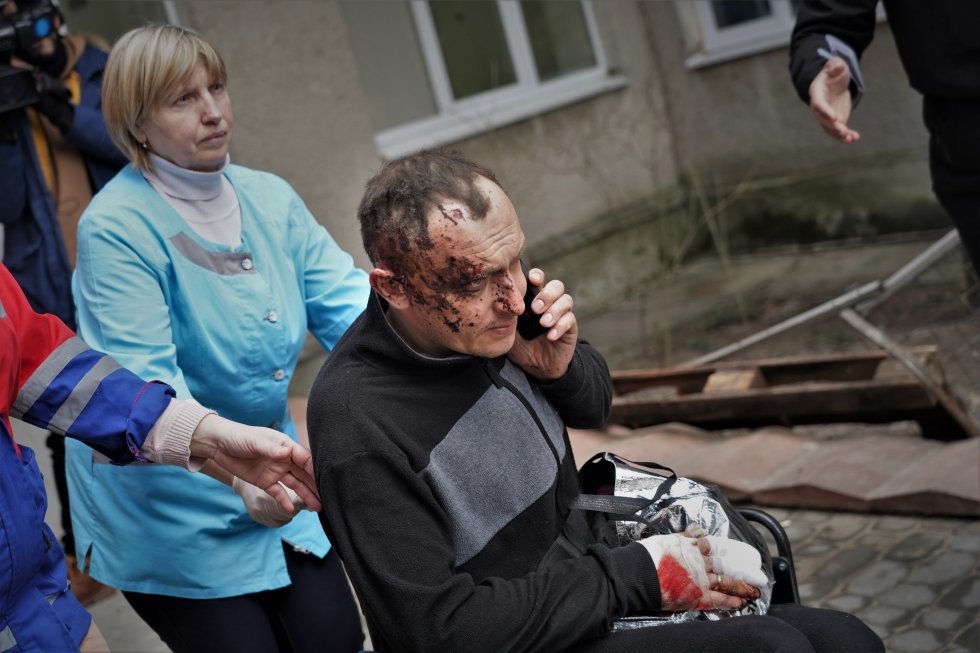 Un militar herido en el bombardeo sobre la base militar de Yavoriv, en Lviv (oeste), este domingo. Un portavoz del Ejército ucranio señala que el ataque, a solo 25 kilómetros de la frontera con Polonia, ha causado 35 muertos y 134 heridos, mientras el ministro de Defensa de Ucrania asegura que en la instalación había “instructores extranjeros”.