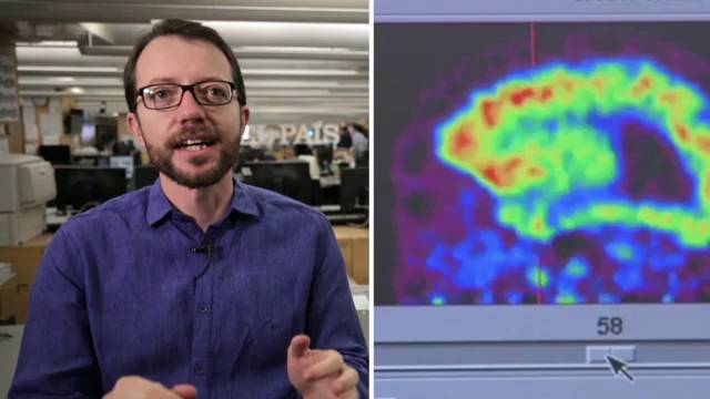Resultado de imagem para Neurocientistas usam InteligÃªncia Artificial para "ler a mente" dos pacientes