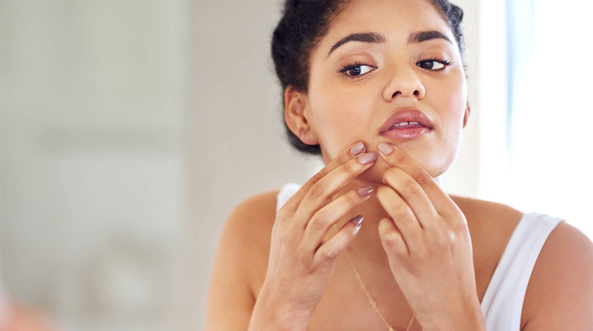 El cosmético "mágico" con el que eliminar los granitos causados por la mascarilla 