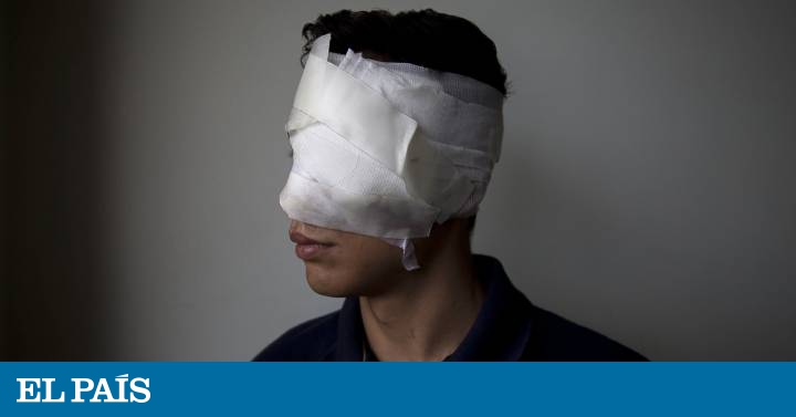 Human Rights Abuses In Venezuela Torture Victims In - 
