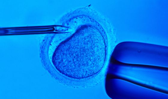 in vitro fertilization reaction The basics: in vitro transcription large scale transcription reactions, generating up to 200 µg of rna per reaction can be used for arna amplification. in vitro fertilization reaction The basics: in vitro transcription large scale transcription reactions, generating up to 200 µg of rna per reaction can be used for arna amplification.
