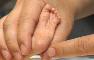 que detecta la prueba del talon en los bebes