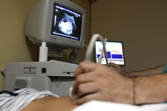 prueba de embarazo de sangre precio costa rica