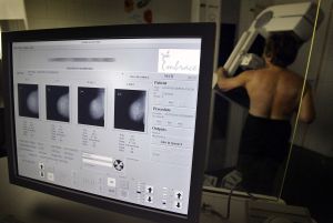 Como se hace el examen de cancer de mama
